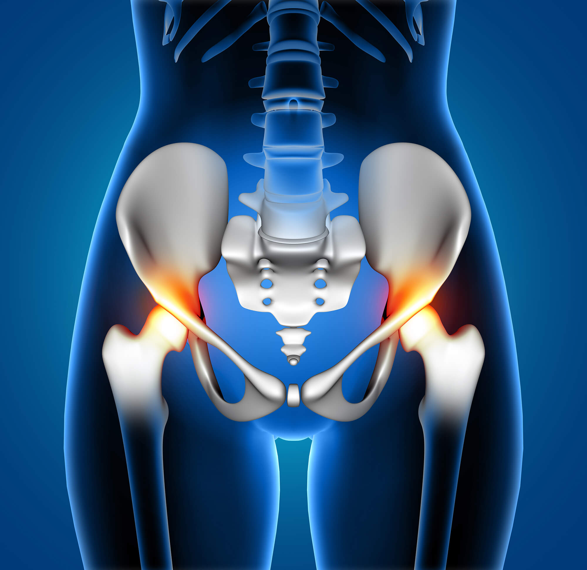 Reducing Post-Operative Pain from Hip Replacement