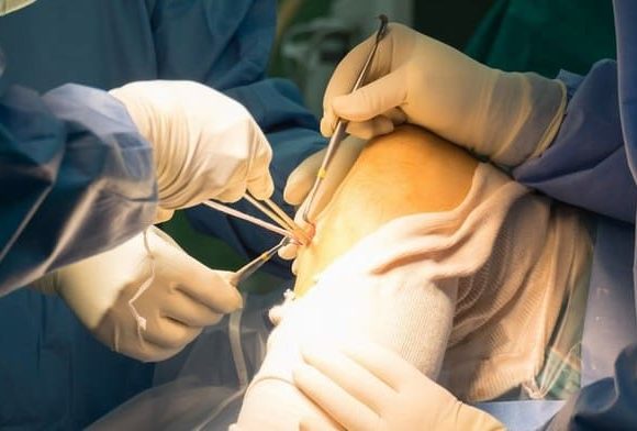 Arthroscopic Knee Reconstruction Vs. Knee Replacement: What’s the Difference?