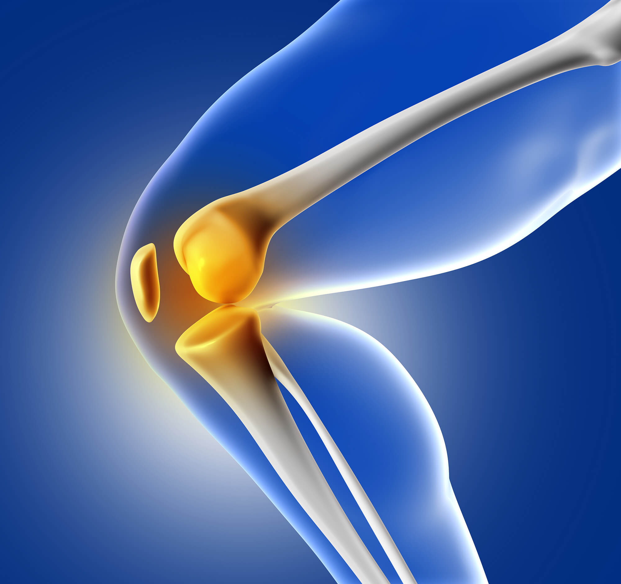 When to Consider Joint Replacement