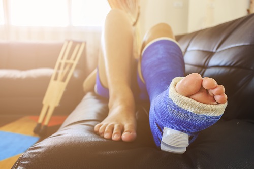 Ankle Sprain & Fracture Surgeries