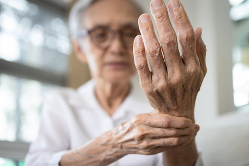 Do You Think You Know Everything about Arthritis? Think Again!