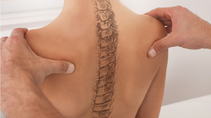 Scoliosis Surgery and Height Gain: What You Need to Know