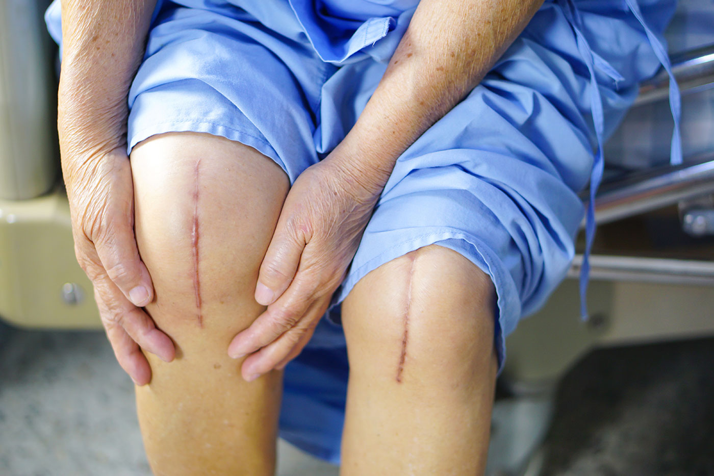The Most Common Knee Surgeries: What You Need to Know