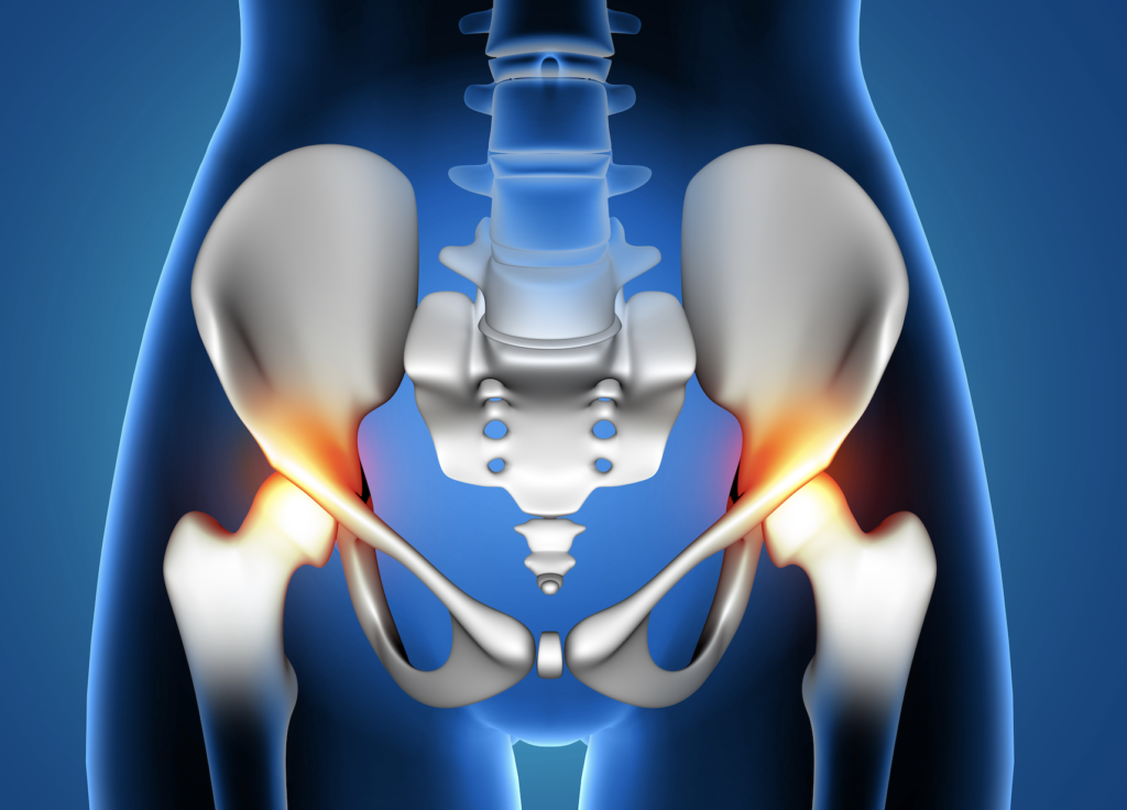 The Gift of Time LongTerm Results of Hip Replacements Huntington